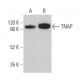 western blotting image from recommended TNAP (TRA-2-39) monoclonal antibody replacement. Image 359715