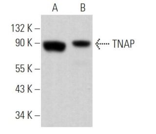 TNAP Antibody (3H415) - Western Blotting - Image 363025