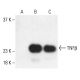 This polyclonal antibody has been discontinued. See our recommended <a href="tnfbeta-antibody-e-6">TNFβ (E-6)</a> monoclonal antibody (sample data shown). western blotting image from recommended TNFβ (E-6) monoclonal antibody replacement. Image 401895