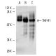 This polyclonal antibody has been discontinued. See our recommended <a href="tnf-r1-antibody-h-5">TNF-R1 (H-5)</a> monoclonal antibody (sample data shown). western blotting image from recommended TNF-R1 (H-5) monoclonal antibody replacement. Image 2857
