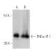 TNFα-IP 1 Antibody (F-4) - Western Blotting - Image 363289