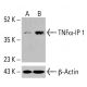 TNFα-IP 1抗体 (F-4): sc-515765。未処理(A)および化学処理(B)HeLa全細胞溶解液におけるTNFα-IP 1発現のウエスタンブロット解析。β-アクチン(C4):sc-47778をローディングコントロールとして使用。検出試薬:m-IgG Fc BP-HRP: sc-525409。 TNFα-IP 1 Antibody (F-4) - Western Blotting - Image 416100
