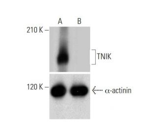 TNIK HDR Plasmid (h): sc-401523-HDR. Western blot analysis of TNIK... 