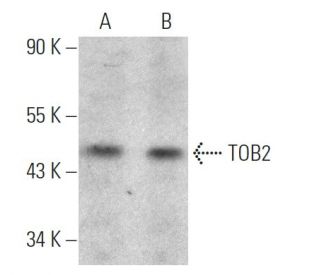 TOB2 Antibody (B-4) - Western Blotting - Image 368552SAM Transcription Activation: SAM system utilizing dCas9-VP64, MS2-P65-HSF1, and sgRNA for precise gene transcription activation.