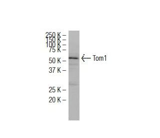 Tom1 Antibody (RQ-07) - Western Blotting - Image 34640 