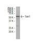 Tom1 Antibody (RQ-07) - Western Blotting - Image 34640 