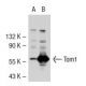 Tom1 Antibody (RQ-07) - Western Blotting - Image 38309