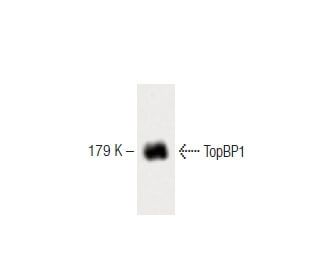 TopBP1 Antibody (33) - Western Blotting - Image 60477 