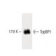 TopBP1 Antibody (33) - Western Blotting - Image 60477 