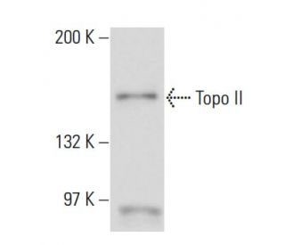 Topo II Antibody (T22C5) - Western Blotting - Image 16456