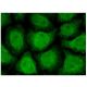 Topo IIβ Antibody (B-6) - Immunofluorescence - Image 151122 