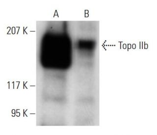 Topo II&beta; Antibody (C-12) - Western Blotting - Image 12798
