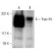 Topo IIβ Antibody (C-12) - Western Blotting - Image 12798