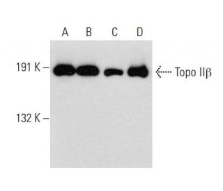 western blotting image from recommended Topo II&beta; (A-12) monoclonal antibody replacement. Image 147413