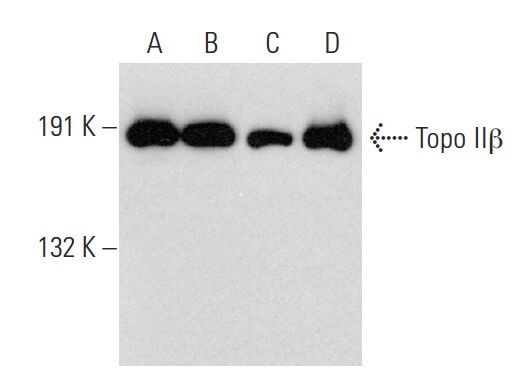 アヌビス2 ターニングポイント topo-iibeta-antibody-h-286-