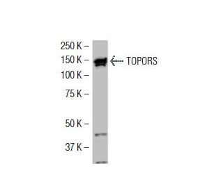 TOPORS Antibody (Y-30) - Western Blotting - Image 34544 