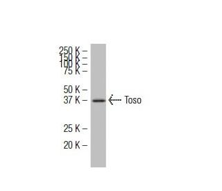 Toso Antibody (RR-16) - Western Blotting - Image 34612