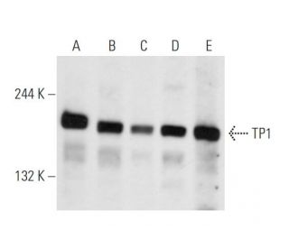 TP1 Antibody (B-1) - Western Blotting - Image 66406SAM Transcription Activation: SAM system utilizing dCas9-VP64, MS2-P65-HSF1, and sgRNA for precise gene transcription activation.