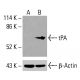 tPA Antibody (D-1) - Western Blotting - Image 416039 