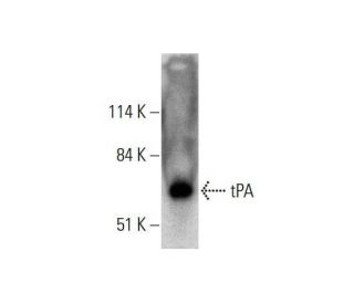 western blotting image from recommended tPA (D-1) monoclonal antibody replacement. Image 351846