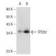 TPD52 Antibody (A-6) - Western Blotting - Image 108865