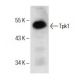Tpk1 Antibody (F-3) - Western Blotting - Image 151639