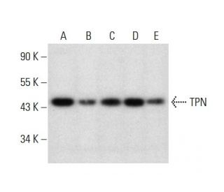 TPN Antibody (E-11) - Western Blotting - Image 297609 