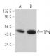TPN Antibody (E-11) - Western Blotting - Image 369891
