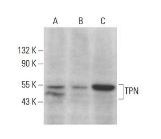 TPN Antibody (TO-3) - Western Blotting - Image 385300 