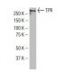 TPR Antibody (3B9) - Western Blotting - Image 34651