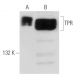 TPR Antibody (3B9) - Western Blotting - Image 52336 