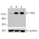 TPX2 抗体 (B-10):sc-390183。未処理の HCT-116 細胞(A)、化学処理した HCT-116 細胞(B)、および HeLa 細胞(C)の全細胞溶解物における TPX2 の発現のウエスタンブロットによる分析。使用した検出試薬:m-IgG2b BP-HRP:sc-542741。β-アクチン(C4):sc-47778 をロードコントロールとして使用。使用した検出試薬:m-IgG Fc BP-HRP:sc-525409。 TPX2 Antibody (B-10) - Western Blotting - Image 415022