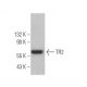 TR2 Antibody (G-11) - Western Blotting - Image 374351