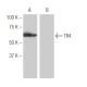 TR4 Antibody (95-P) - Western Blotting - Image 53998
