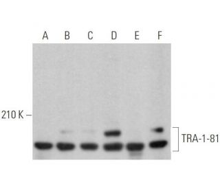 TRA-1-81 Antibody (TRA-1-80) - Western Blotting - Image 352706 