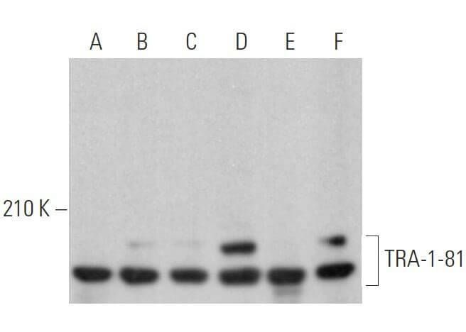 TRA-1-81 Antibody (TRA-1-80) | SCBT - Santa Cruz Biotechnology