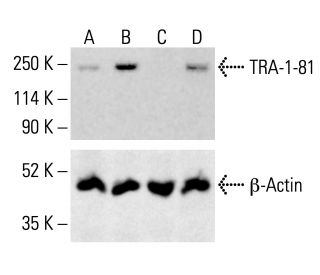 TRA-1-81 Antibody (TRA-1-80) | SCBT - Santa Cruz Biotechnology