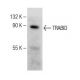TRABID Antibody (F-1) - Western Blotting - Image 150221 