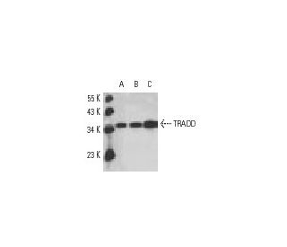 western blotting image from recommended TRADD (A-5) monoclonal antibody replacement. Image 10917