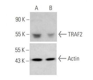 TRAF2 siRNA (h): sc-29509. Western blot analysis of TRAF2 expression in non-transfected control (A) and TRAF2 siRNA transf 