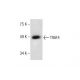western blotting image from recommended TRAF4 (B-9) monoclonal antibody replacement. Image 286930