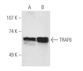 western blotting image from recommended TRAF6 (D-10) monoclonal antibody replacement. Image 3228