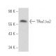 western blotting image from recommended TRα1/α2 (2103) monoclonal antibody replacement. Image 17181