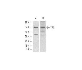 western blotting image from recommended TR&alpha;1/&beta;1 (C4) monoclonal antibody replacement. Image 1759
