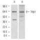 western blotting image from recommended TRα1/β1 (C4) monoclonal antibody replacement. Image 1759