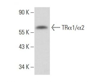 TR&alpha;1/&alpha;2 Antibody (3C185) - Western Blotting - Image 17182