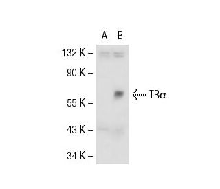 TR&alpha;1/&beta;1 Antibody (C1) - Western Blotting - Image 55103 