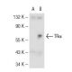 TRα1/β1 Antibody (C1) - Western Blotting - Image 55103 