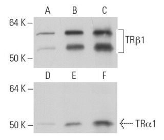 TR&alpha;1/&beta;1 Antibody (C3) - Western Blotting - Image 11901