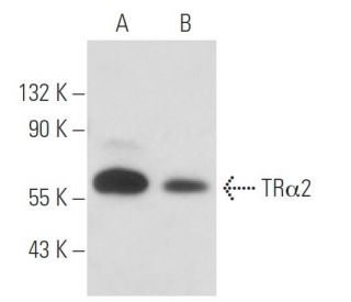 TR&alpha;2 Antibody (1330) - Western Blotting - Image 17183